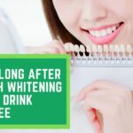 How long after Teeth Whitening can I Drink Coffee