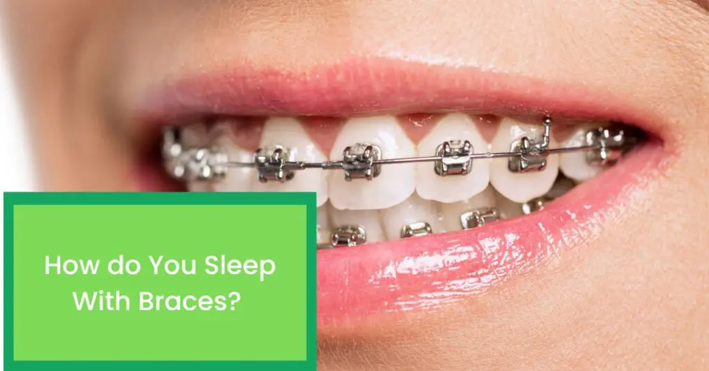 How do You Sleep With Braces? Things You Should Know About Sleeping With Braces.