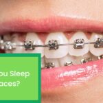 How do You Sleep With Braces? Things You Should Know About Sleeping With Braces.