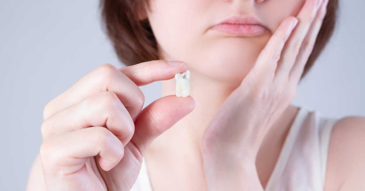 Can I Drink Kombucha After Wisdom Teeth Removal? Talk Leisure