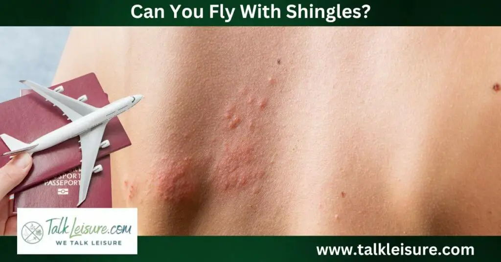 Can You Fly With Shingles?
